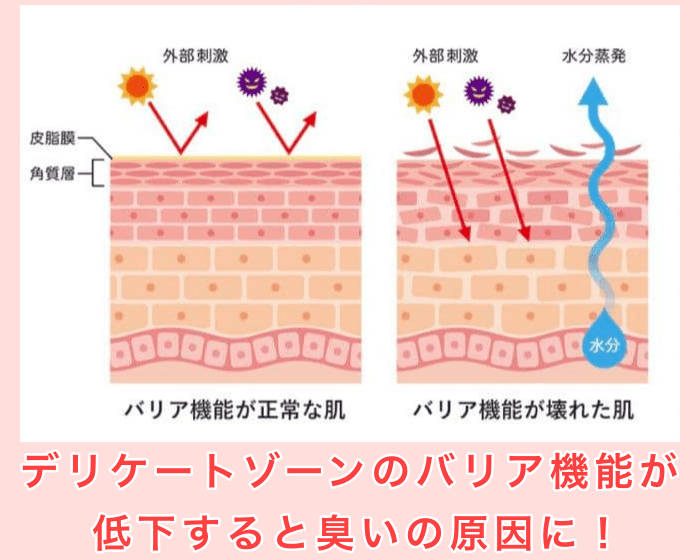 デリケートゾーンのバリア機能が弱まると臭いの原因になる